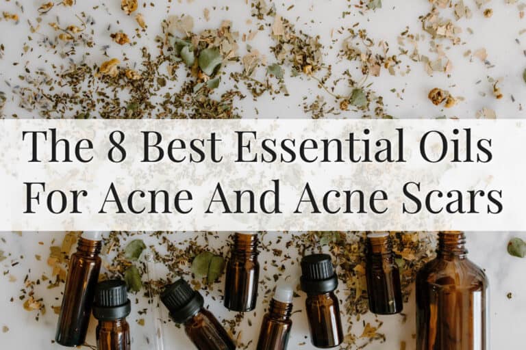 Featured Image - Essential Oils For Acne