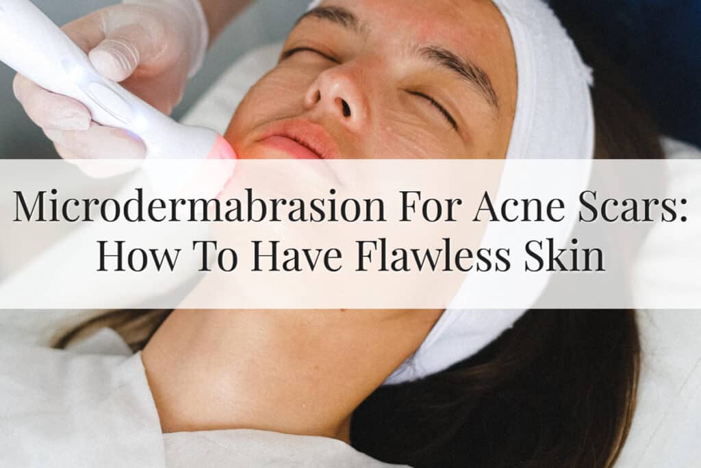 Featured Image - Microdermabrasion For Acne Scars
