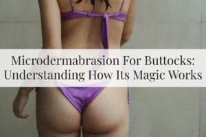 Featured Image - Microdermabrasion For Buttocks