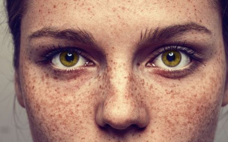 Frontal shot of woman with freckles